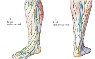 Vascular Changes Associated with Ageing